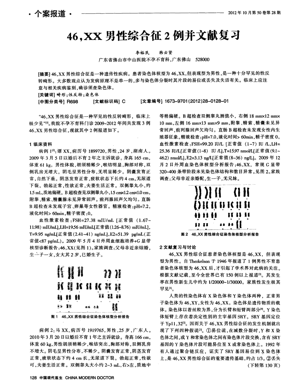 期刊46,xx男性综合征2例并文献复习被引量:4    46,xx男性综合征是一