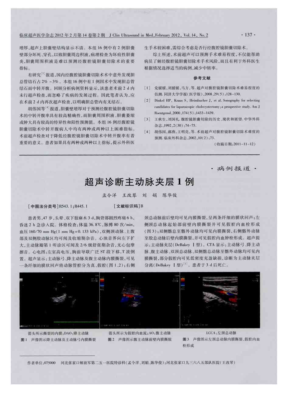 期刊超声诊断主动脉夹层1例      患者男,47岁,头晕,双下肢麻术3d,胸