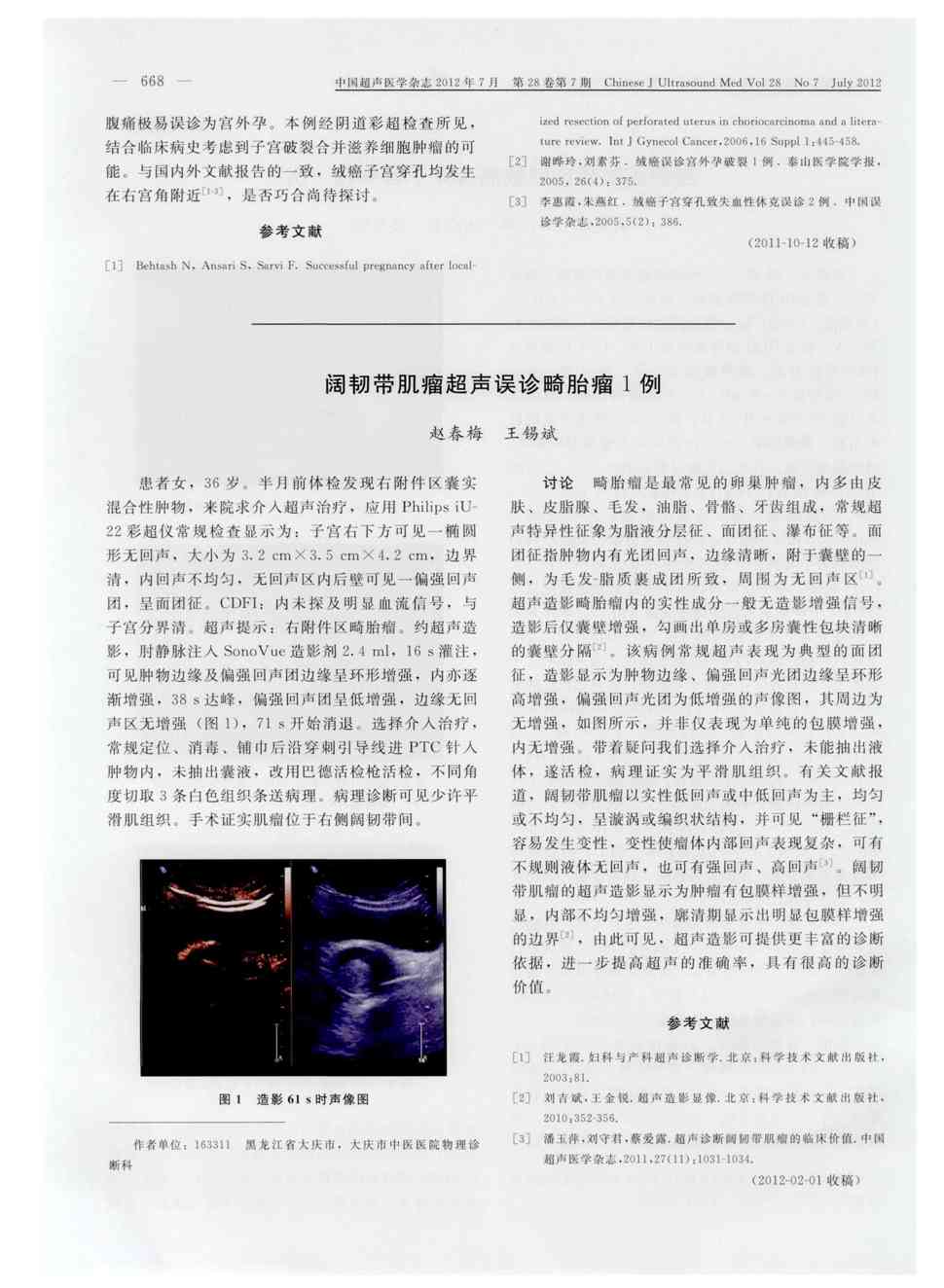 期刊阔韧带肌瘤超声误诊畸胎瘤1例