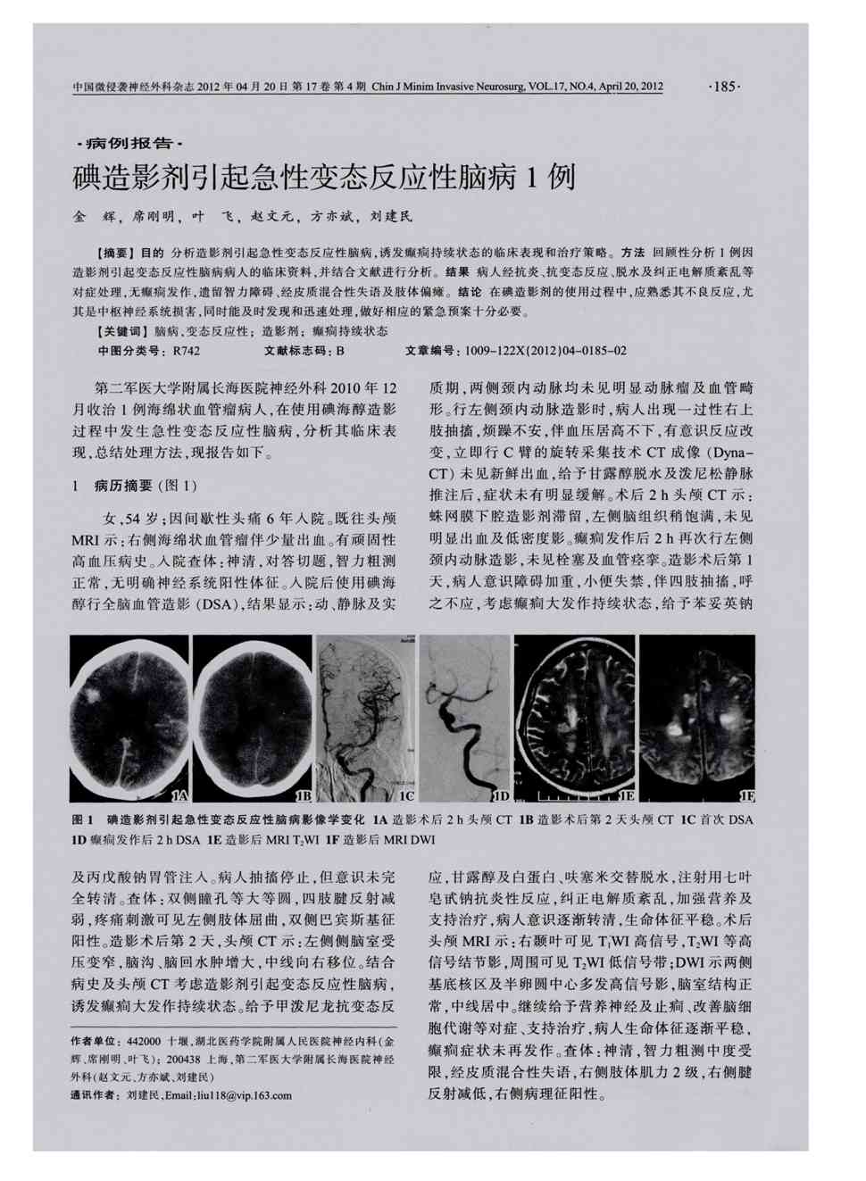 期刊碘造影剂引起急性变态反应性脑病1例被引量:5        目的分析