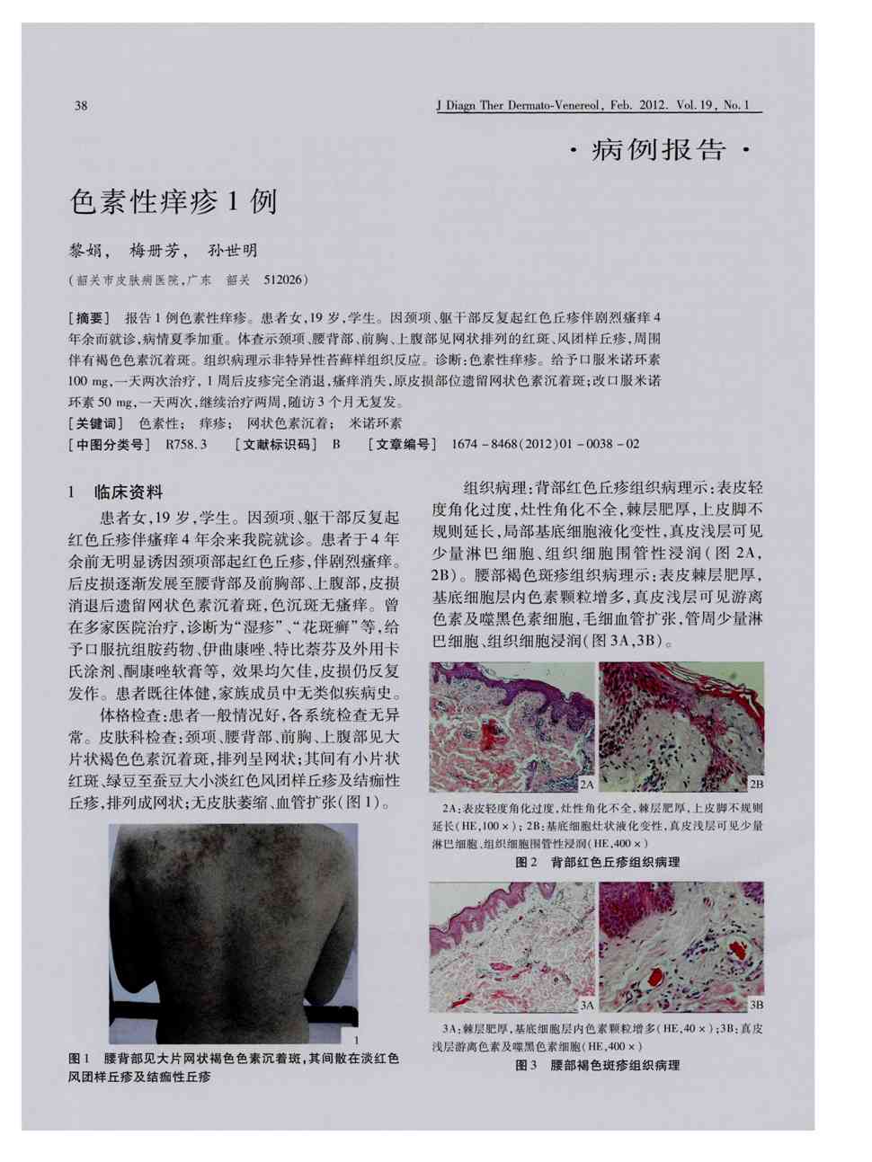 《皮肤性病诊疗学杂志》2012年第1期 38-39,共2页黎娟梅册芳孙世明