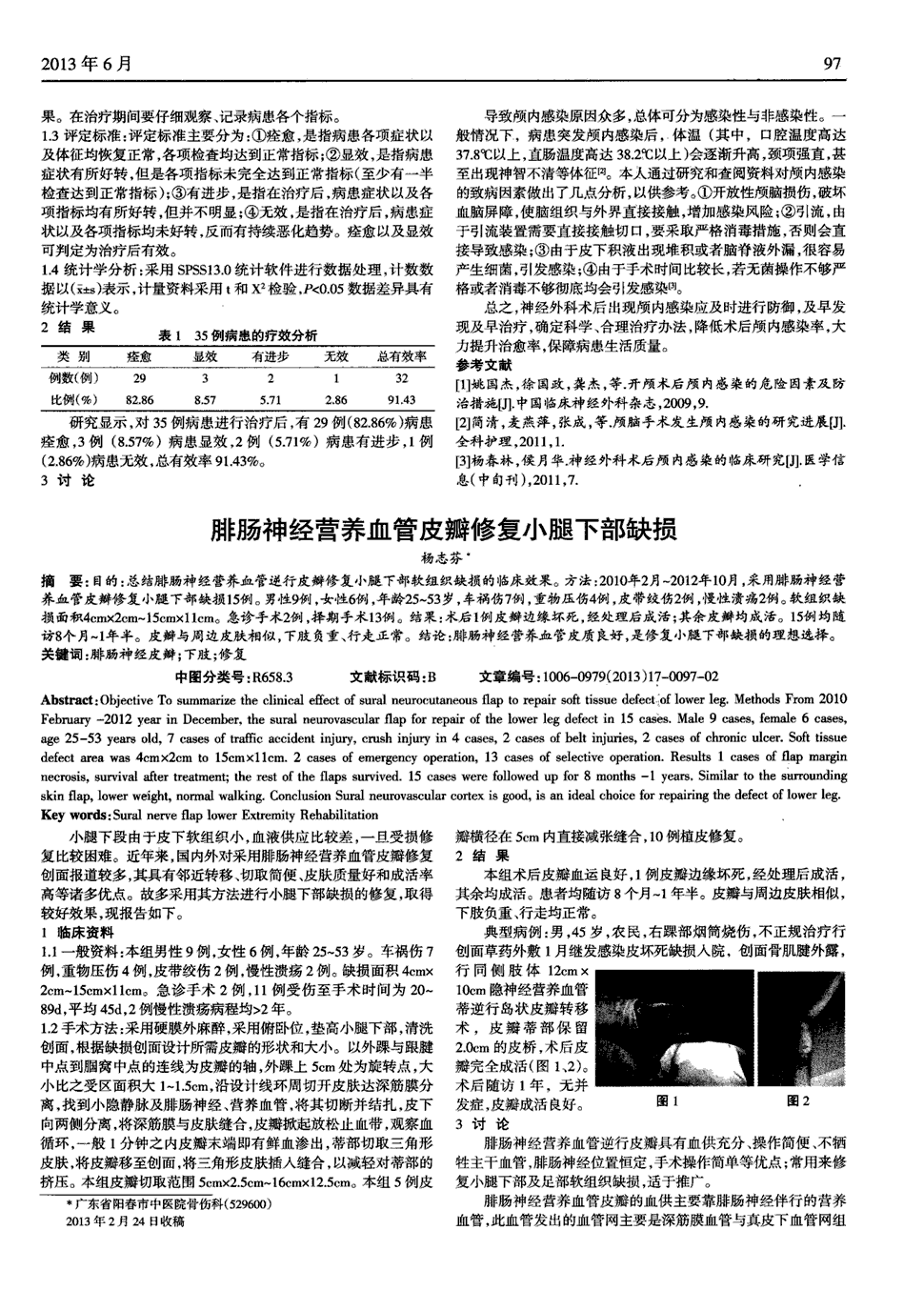 期刊腓肠神经营养血管皮瓣修复小腿下部缺损被引量:1   目的:总结腓