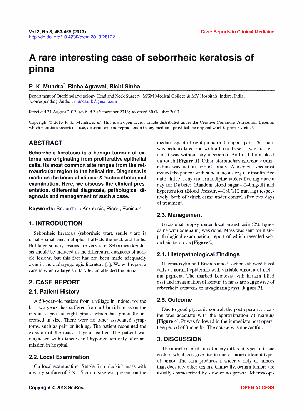 期刊a rare interesting case of seborrheic keratosis of pinna