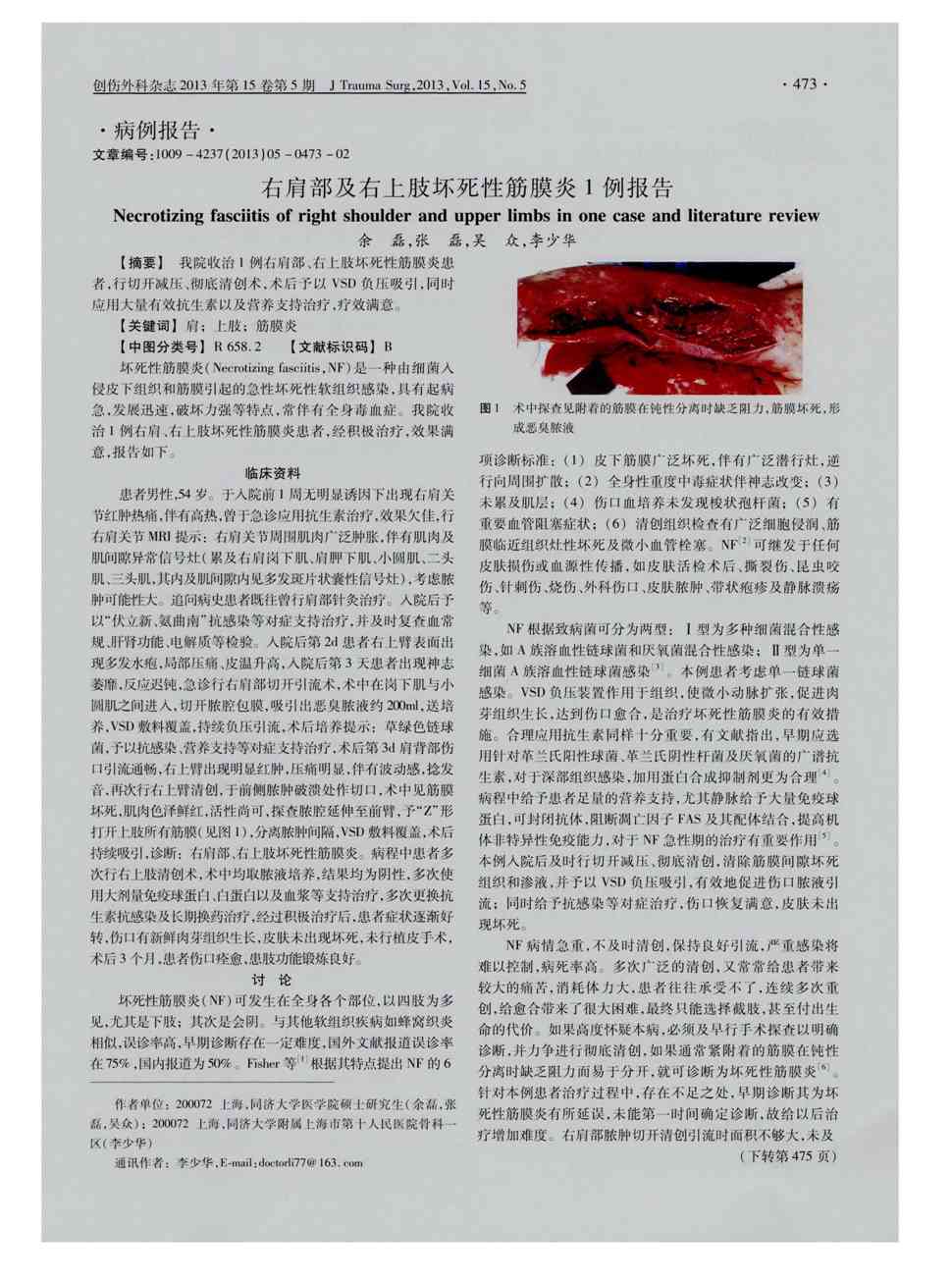 期刊右肩部及右上肢坏死性筋膜炎1例报告被引量:1      我院收治1例