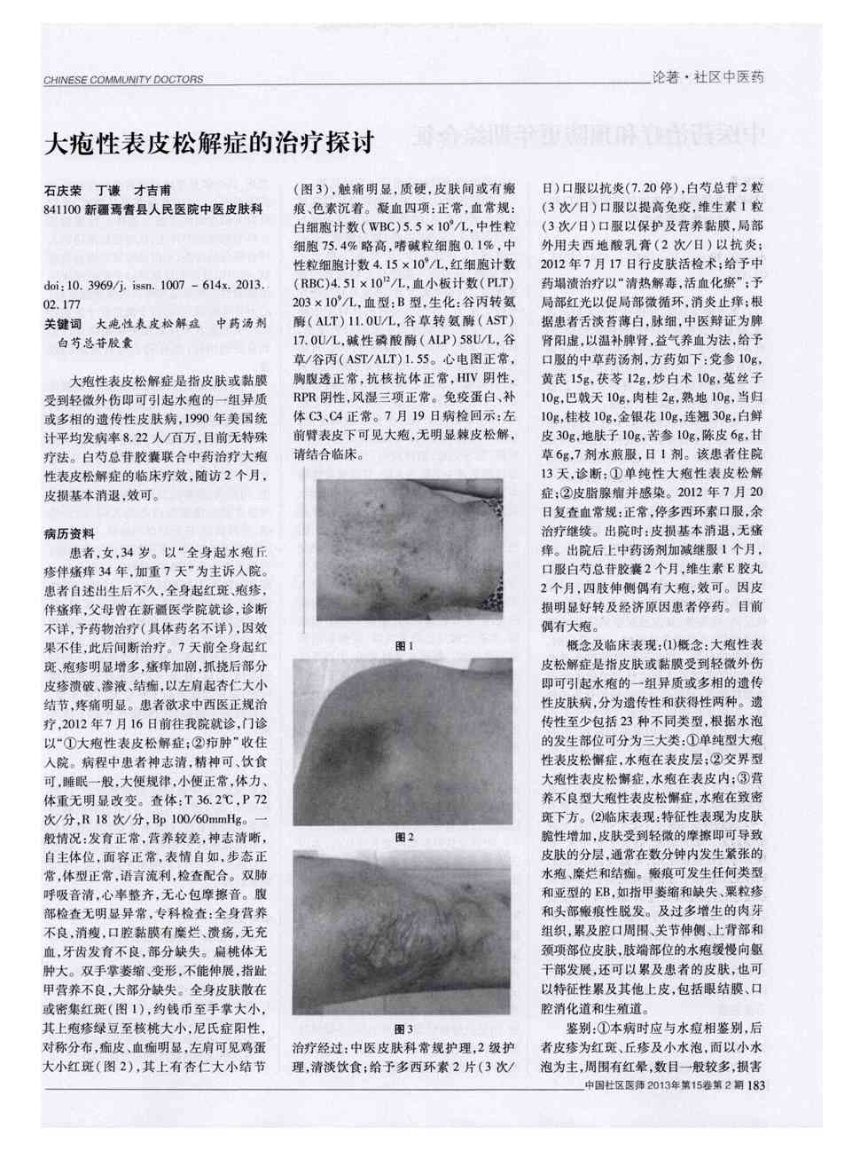 期刊大疱性表皮松解症的治疗探讨被引量:1     大疱性表皮松解症是指