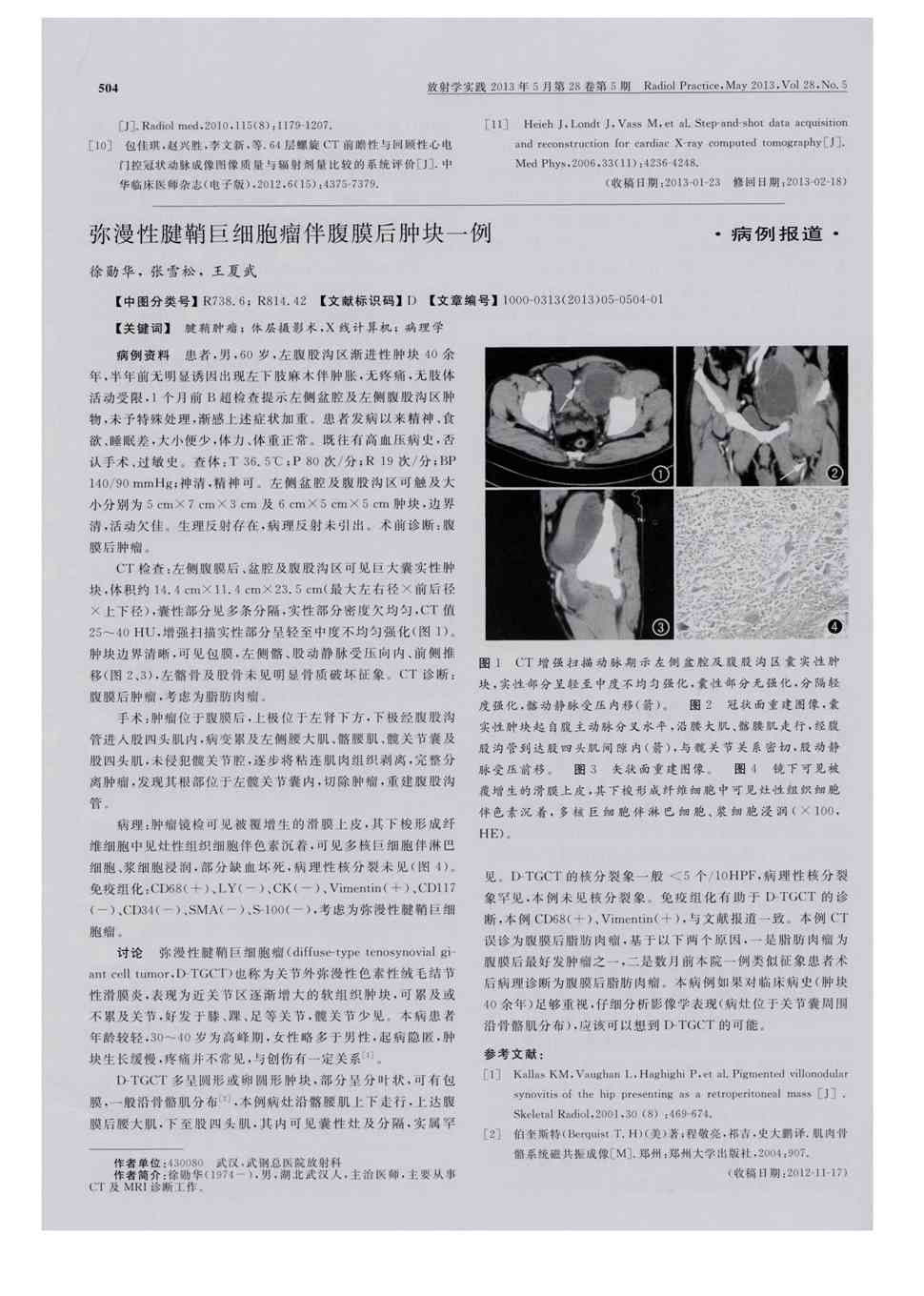 期刊弥漫性腱鞘巨细胞瘤伴腹膜后肿块一例     病例资料患者,男,60岁