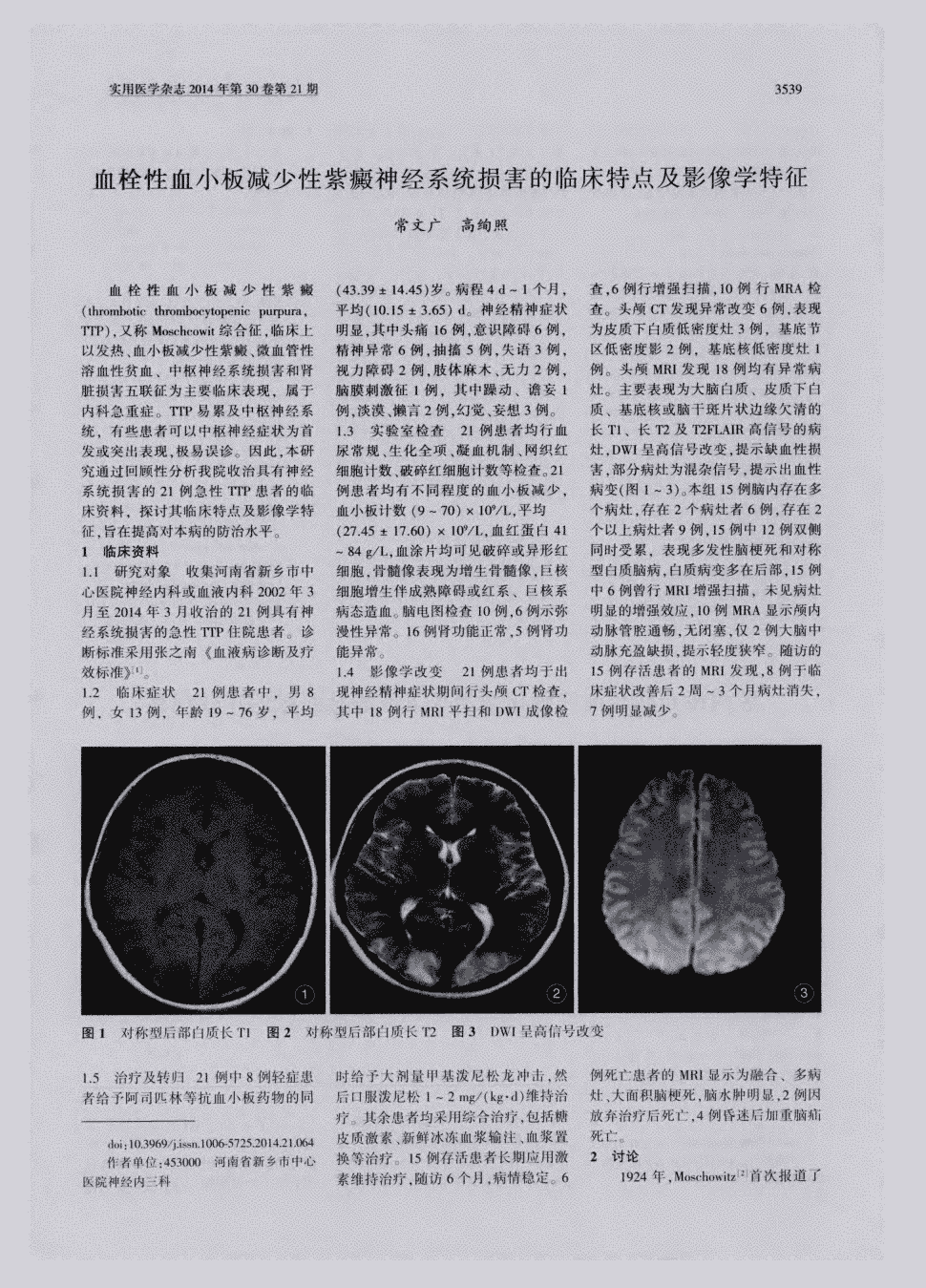 微血管性溶血性贫血,中枢神经系统损害和肾脏损害五联征为主要临床