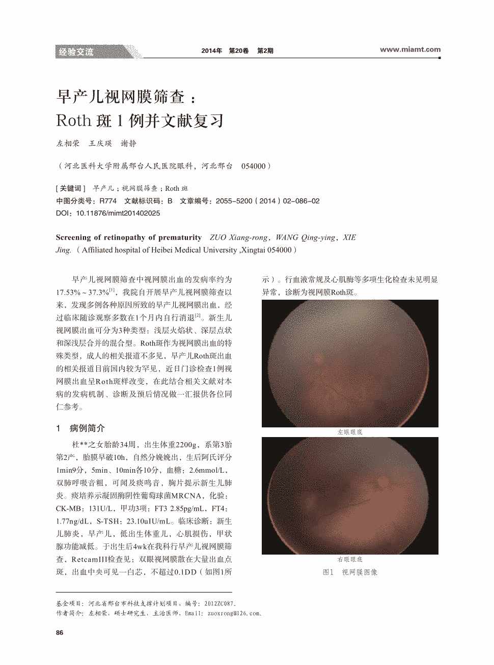 期刊早产儿视网膜筛查:roth斑1例并文献复习