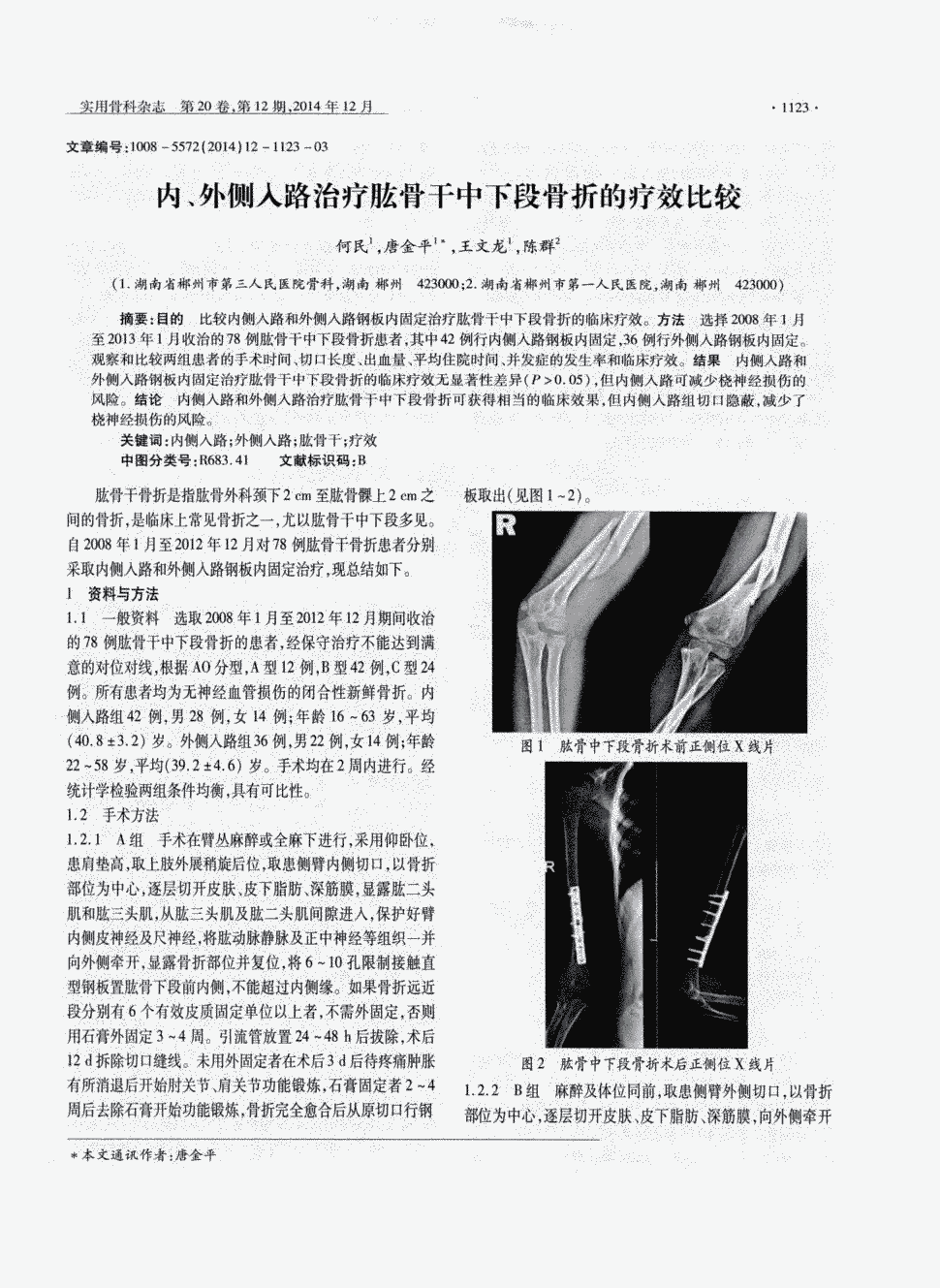 期刊内,外侧入路治疗肱骨干中下段骨折的疗效比较被引量:1      目的