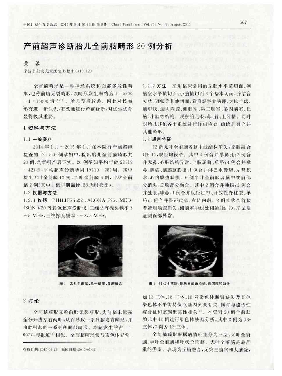 期刊产前超声诊断胎儿全前脑畸形20例分析被引量:1   全前脑畸形是一
