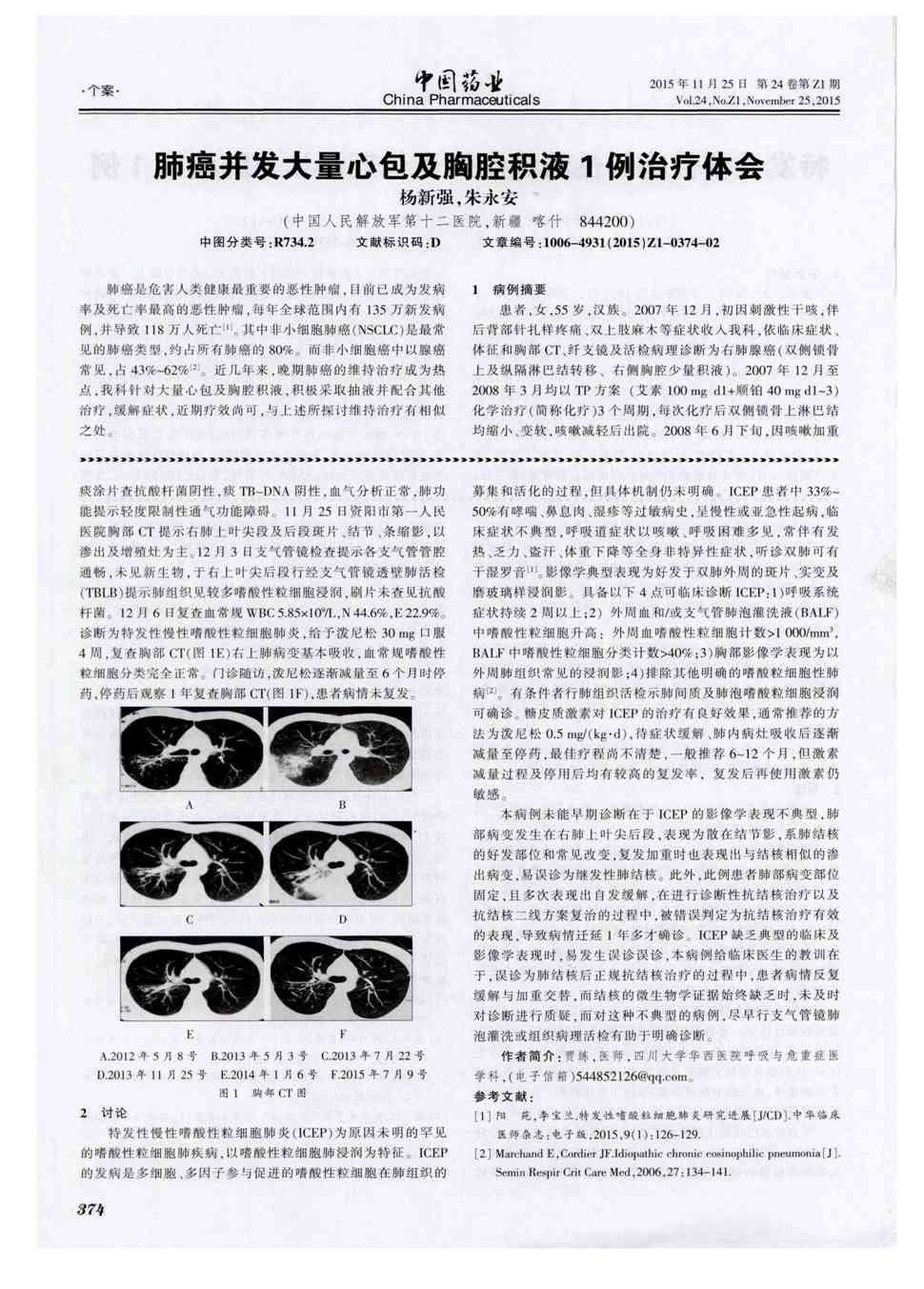 期刊肺癌并发大量心包及胸腔积液1例治疗体会    肺癌是危害人类健康