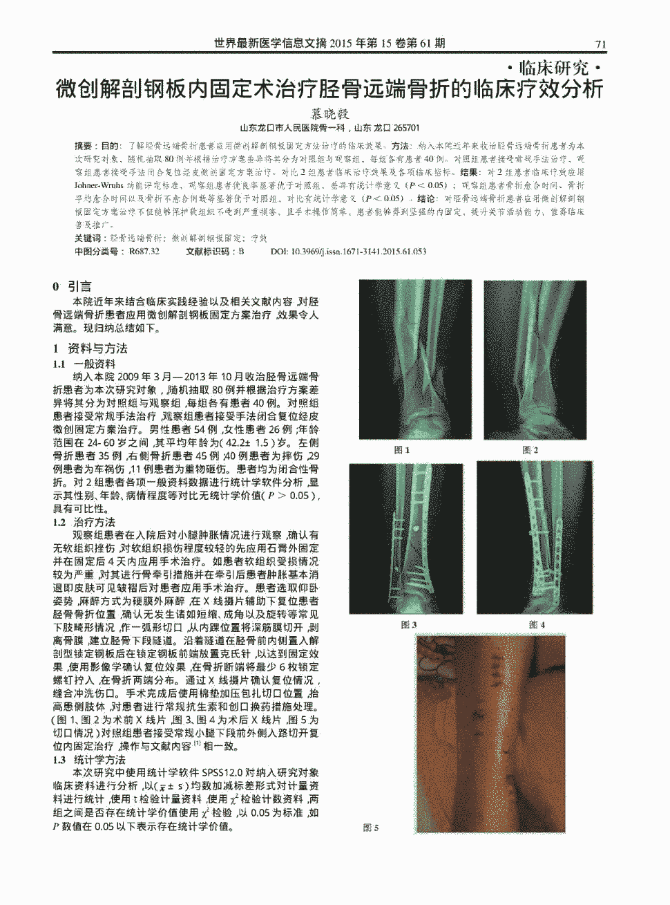 期刊微创解剖钢板内固定术治疗胫骨远端骨折的临床疗效分析被引量:2