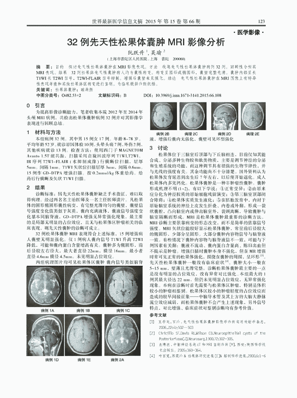 期刊32例先天性松果体囊肿mri影像分析被引量:1    目的探讨先天性