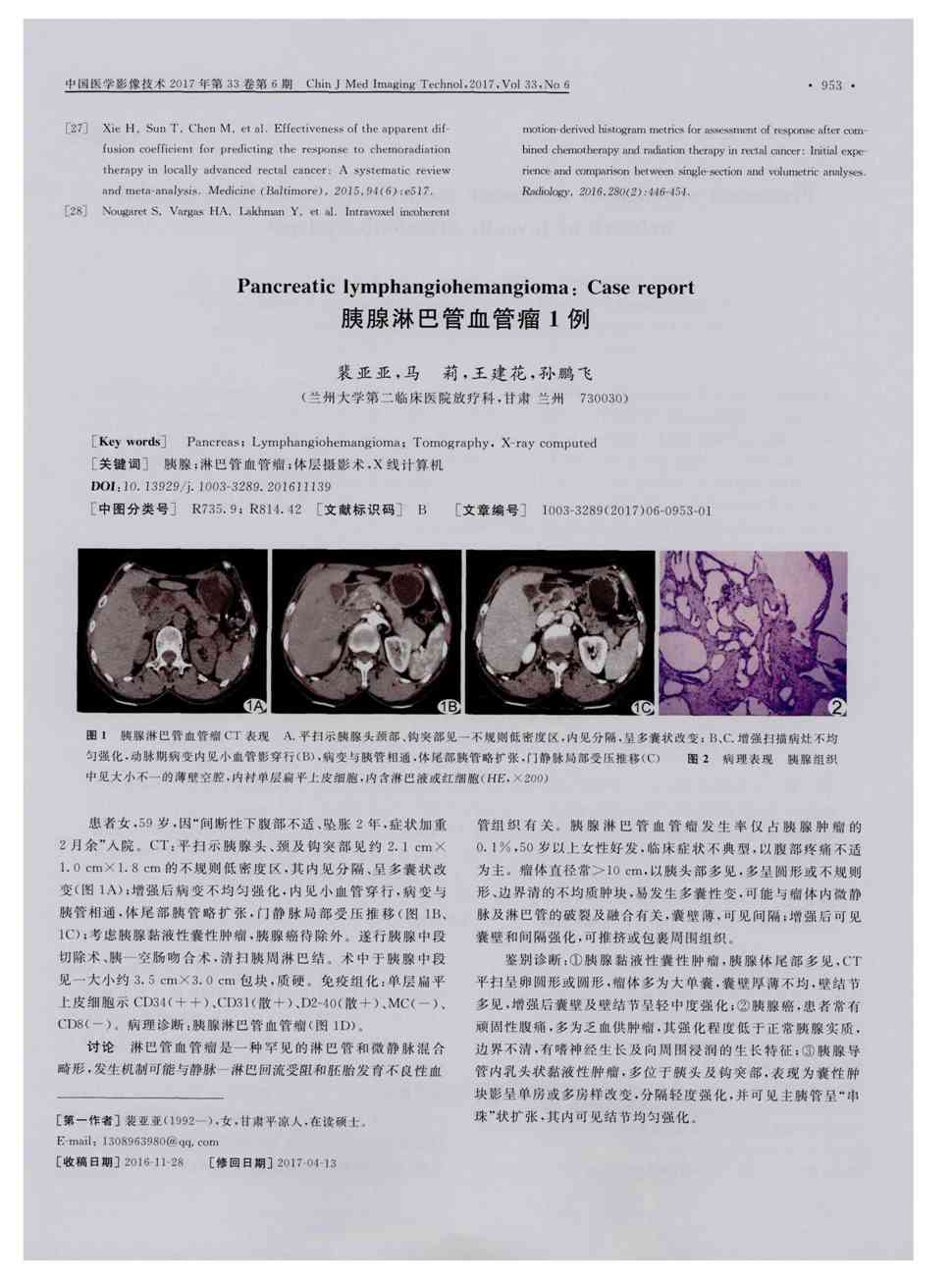 期刊胰腺淋巴管血管瘤1例      患者女,59岁,因"间断性下腹部不适,坠