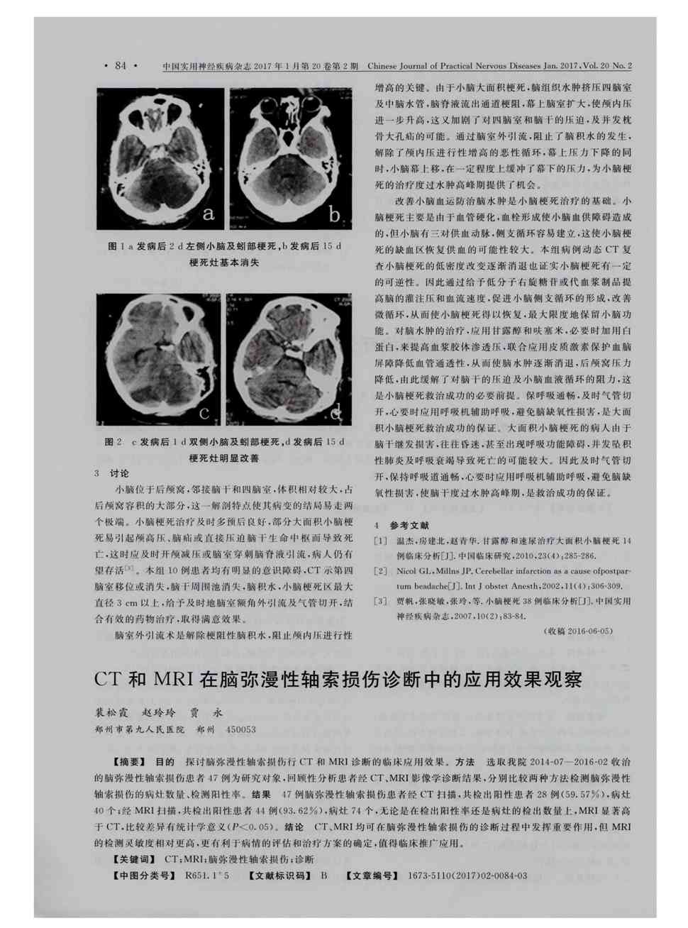 期刊ct和mri在脑弥漫性轴索损伤诊断中的应用效果观察被引量:3