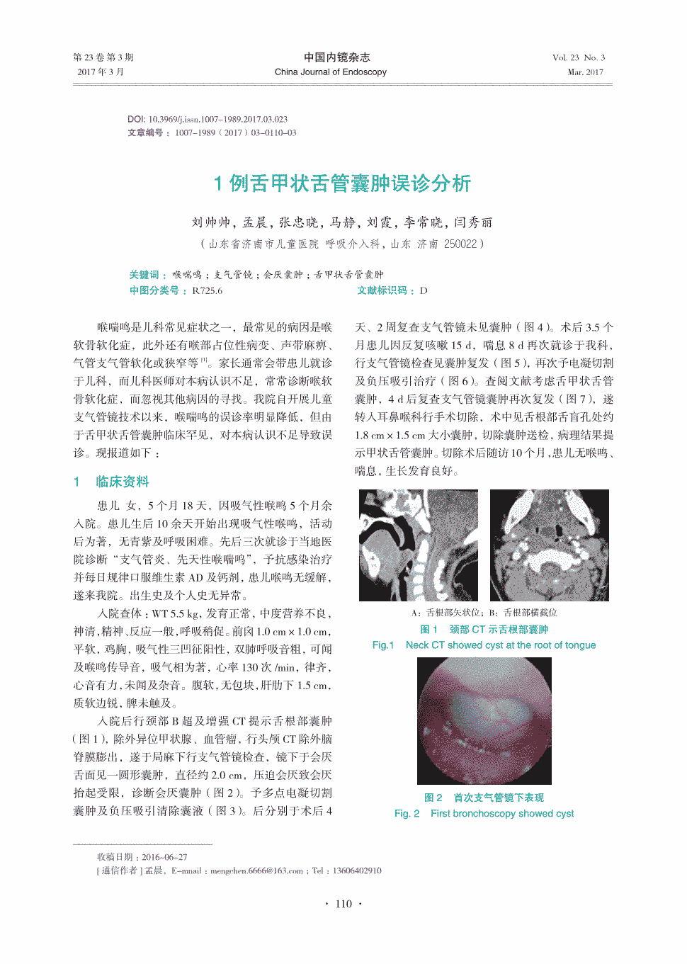 期刊1例舌甲状舌管囊肿误诊分析被引量:2         喉喘鸣是儿科常见