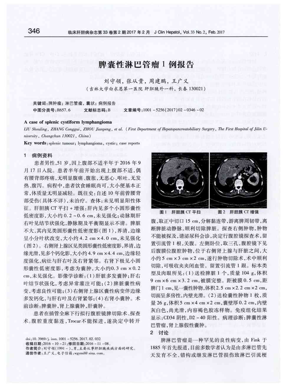 期刊脾囊性淋巴管瘤1例报告      1病例资料患者男性,51岁,因上腹部