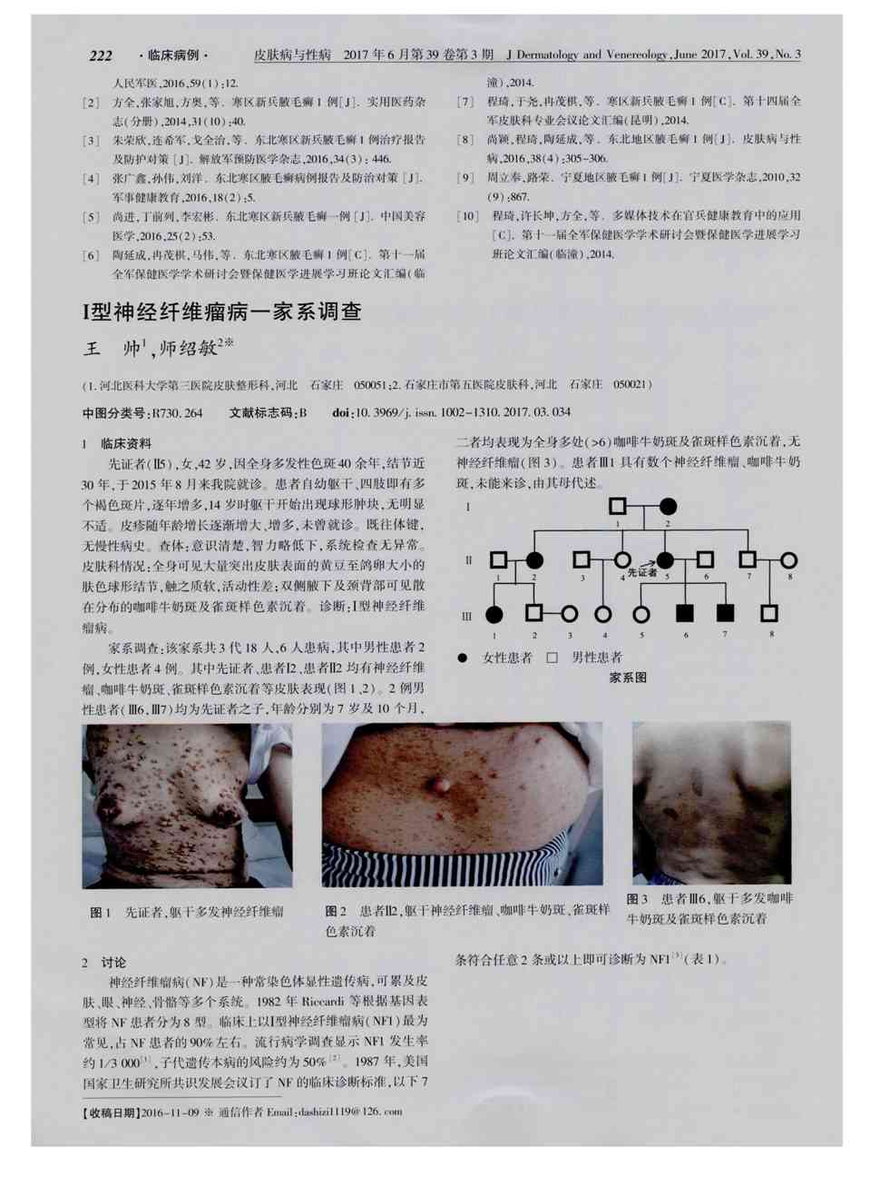 期刊Ⅰ型神经纤维瘤病一家系调查    1临床资料 先证者(Ⅱ5),女,42岁