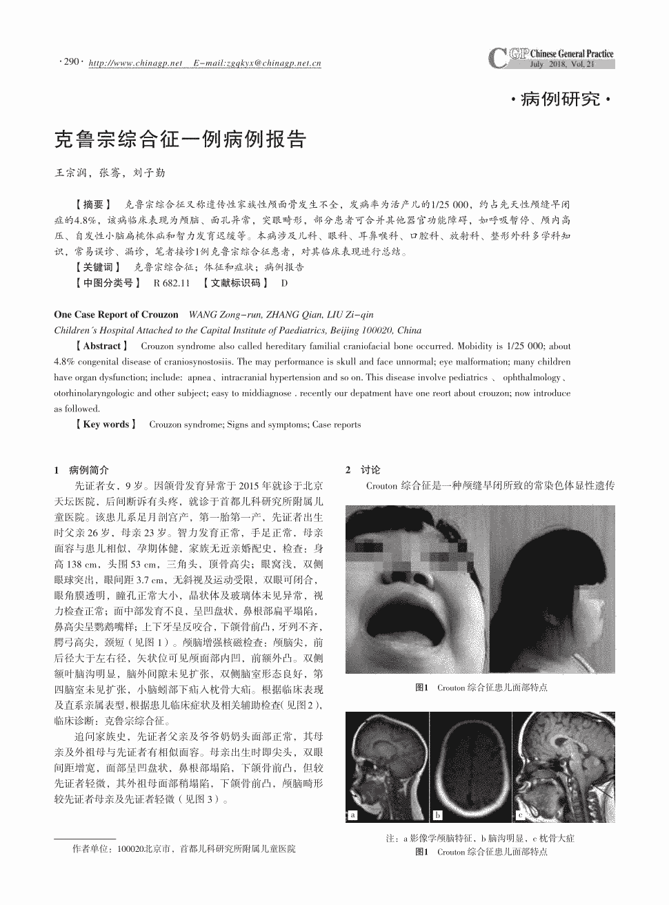 期刊克鲁宗综合征一例病例报告     克鲁宗综合征又称遗传性家族性颅