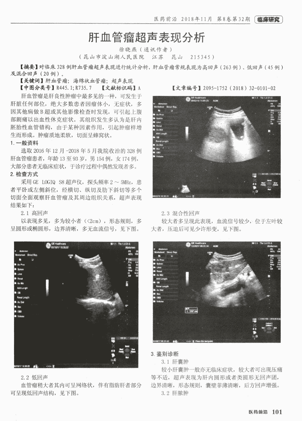 关键词:肝血管瘤 海绵状血管瘤 超声表现