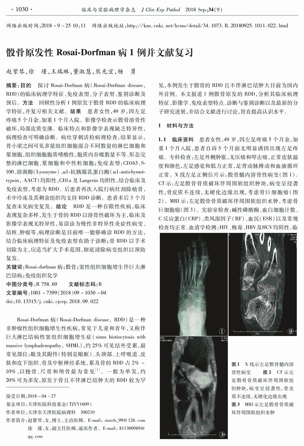 期刊骰骨原发性rosai-dorfman病1例并文献复习