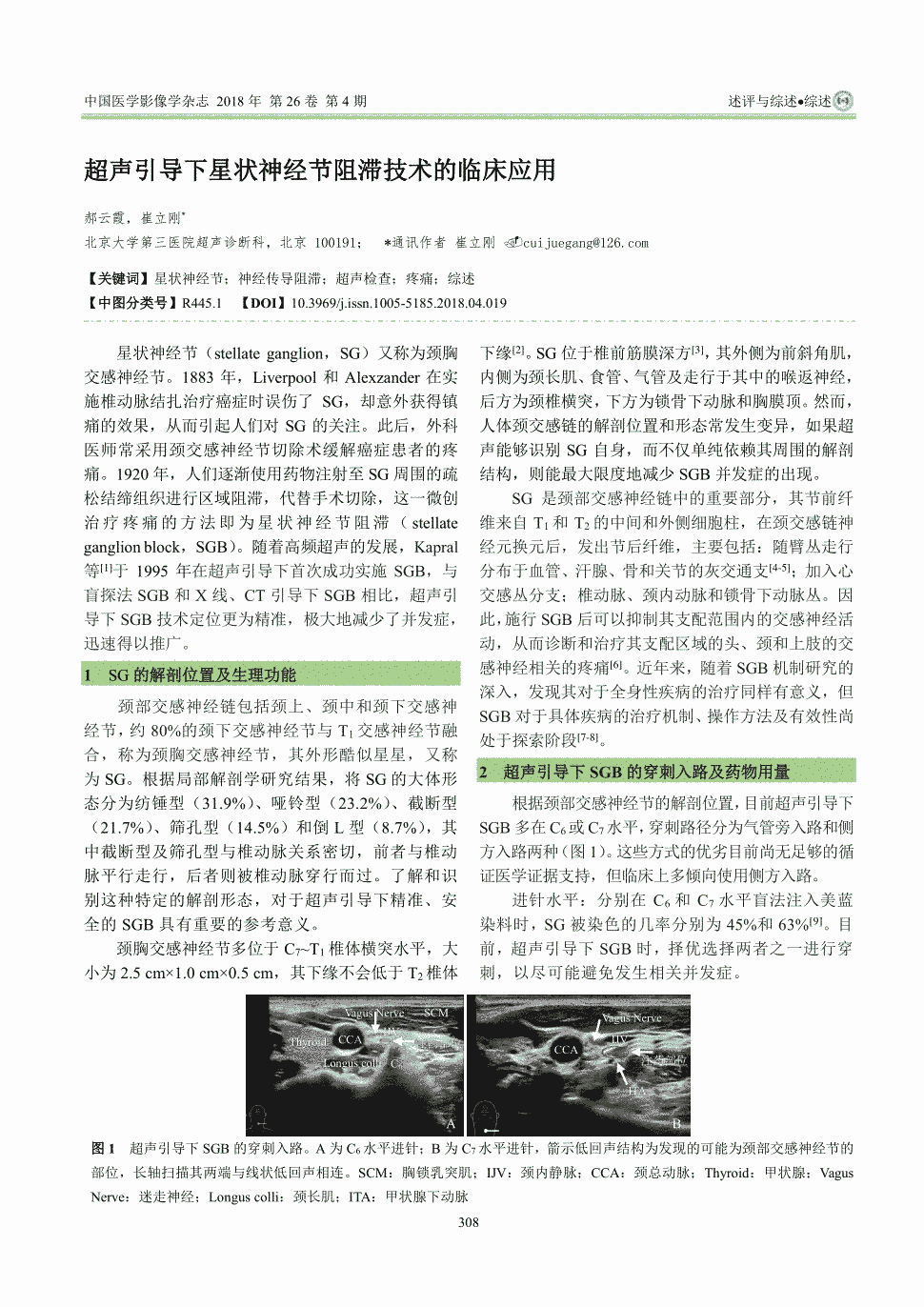 期刊超声引导下星状神经节阻滞技术的临床应用被引量:4    星状神经