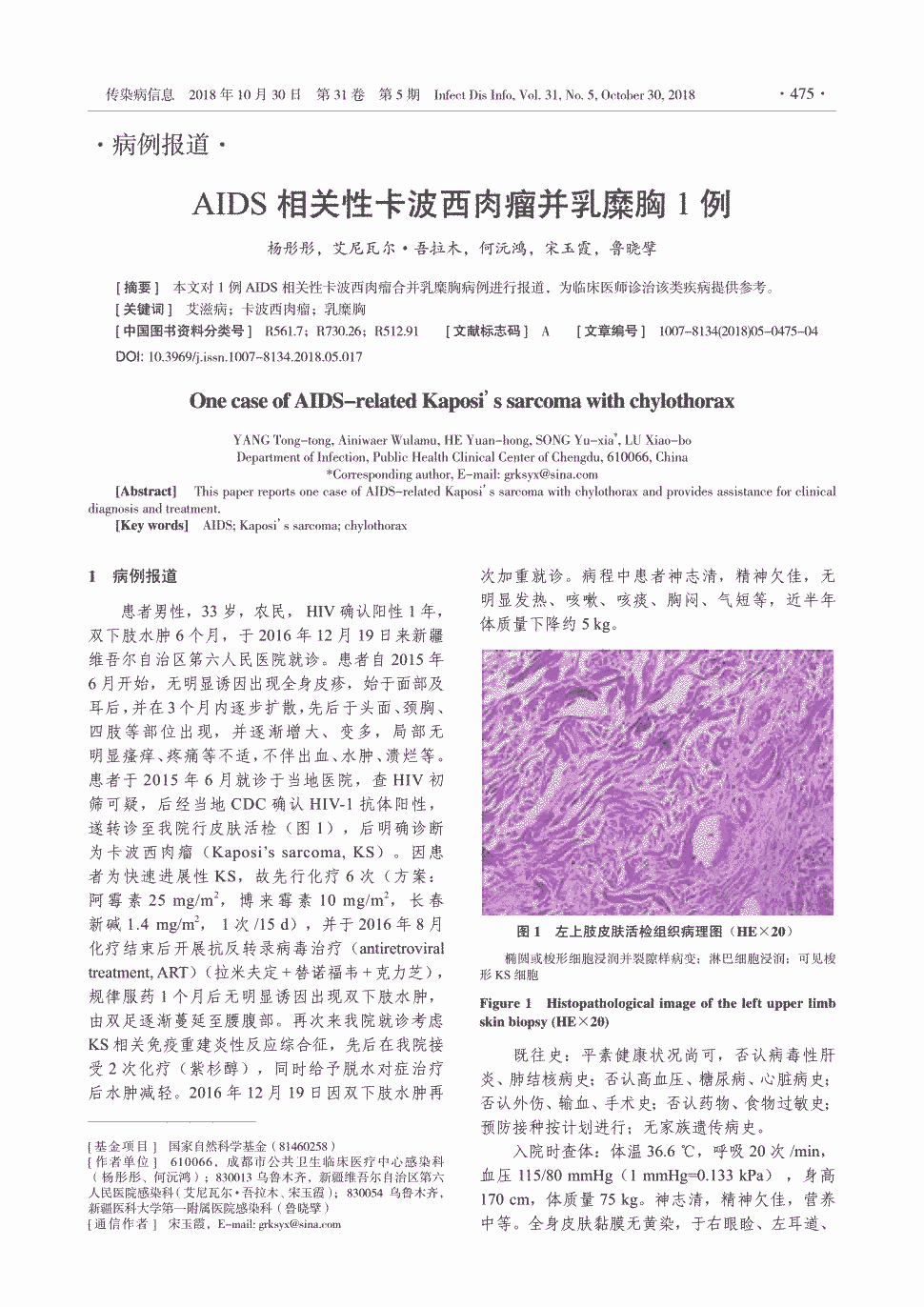 期刊aids相关性卡波西肉瘤并乳糜胸1例