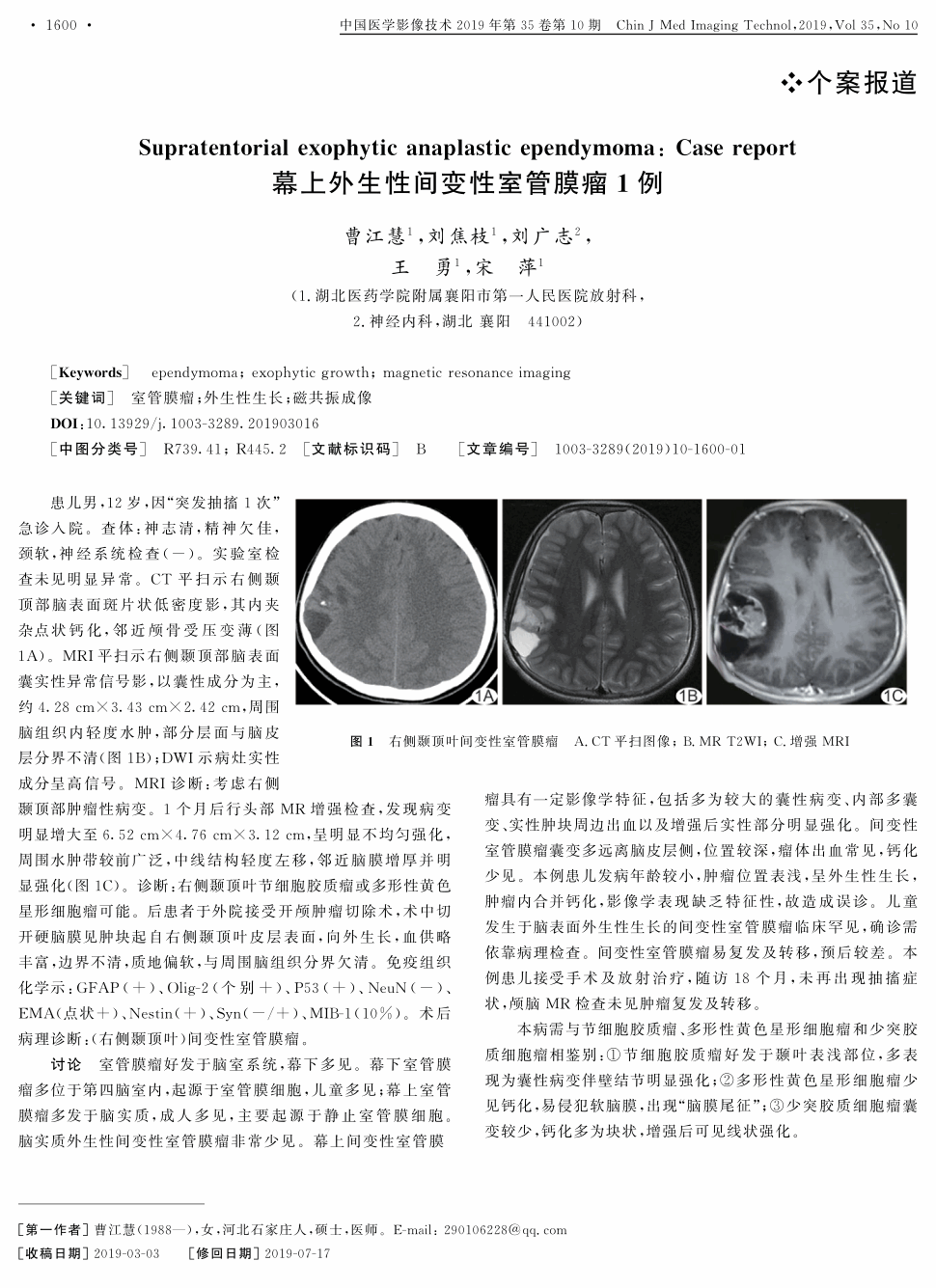 期刊幕上外生性间变性室管膜瘤1例       患儿男,12岁,因"突发抽搐1