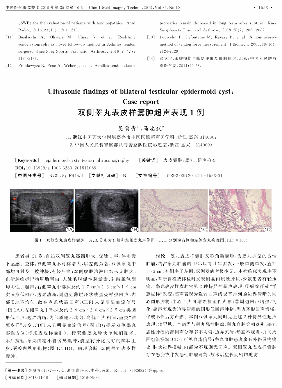 双侧睾丸中部均可触及1枚肿块,有轻压痛;双侧腹股沟淋巴结未见肿大