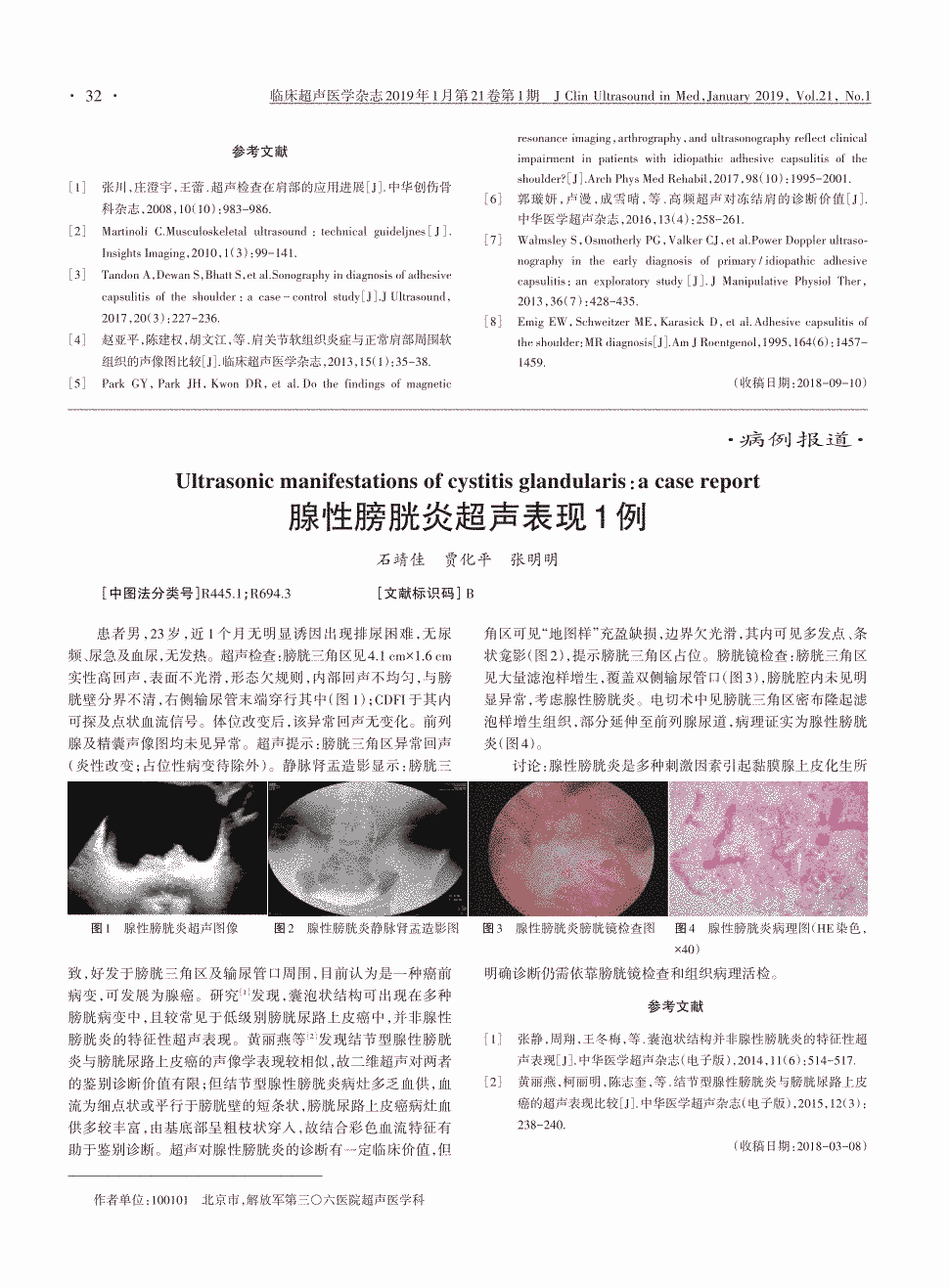 期刊腺性膀胱炎超声表现1例     患者男,23岁,近1个月无明显诱因出现