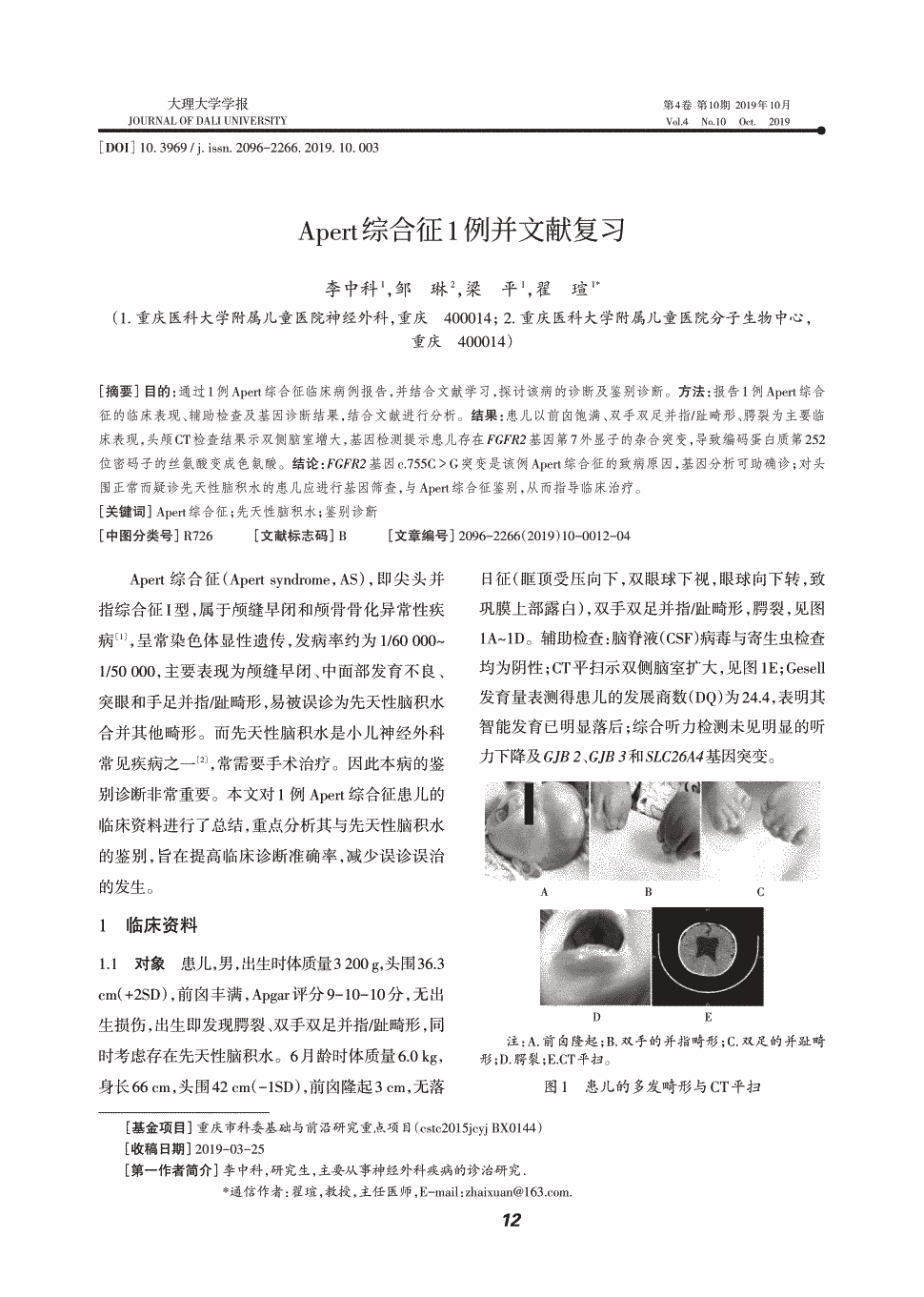 期刊apert综合征1例并文献复习