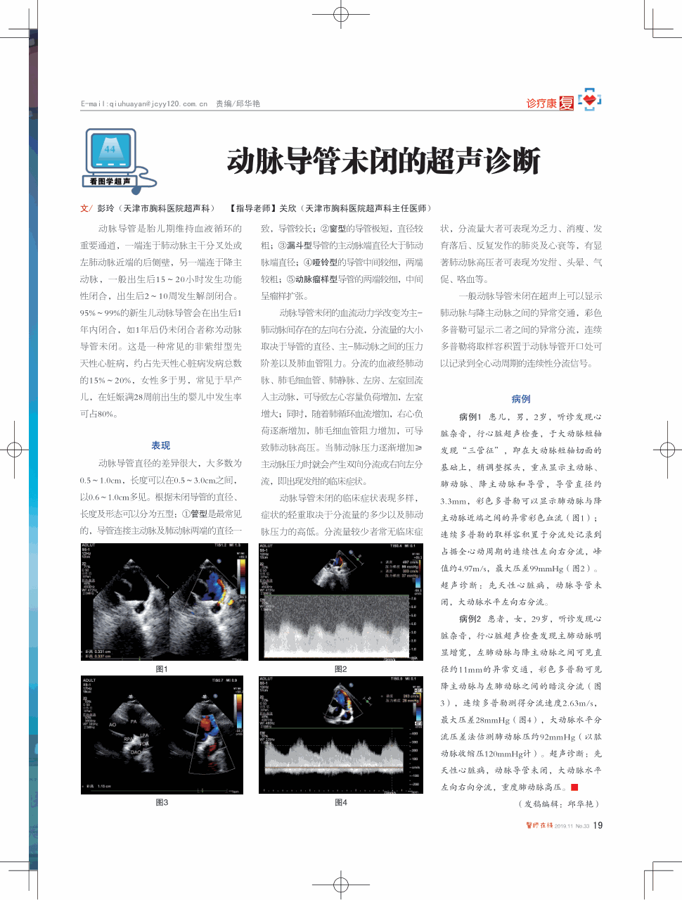 期刊动脉导管未闭的超声诊断    动脉导管是胎儿期维持血液循环的