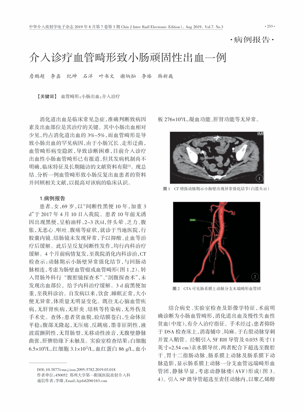 期刊介入诊疗血管畸形致小肠顽固性出血一例          消化道出血是