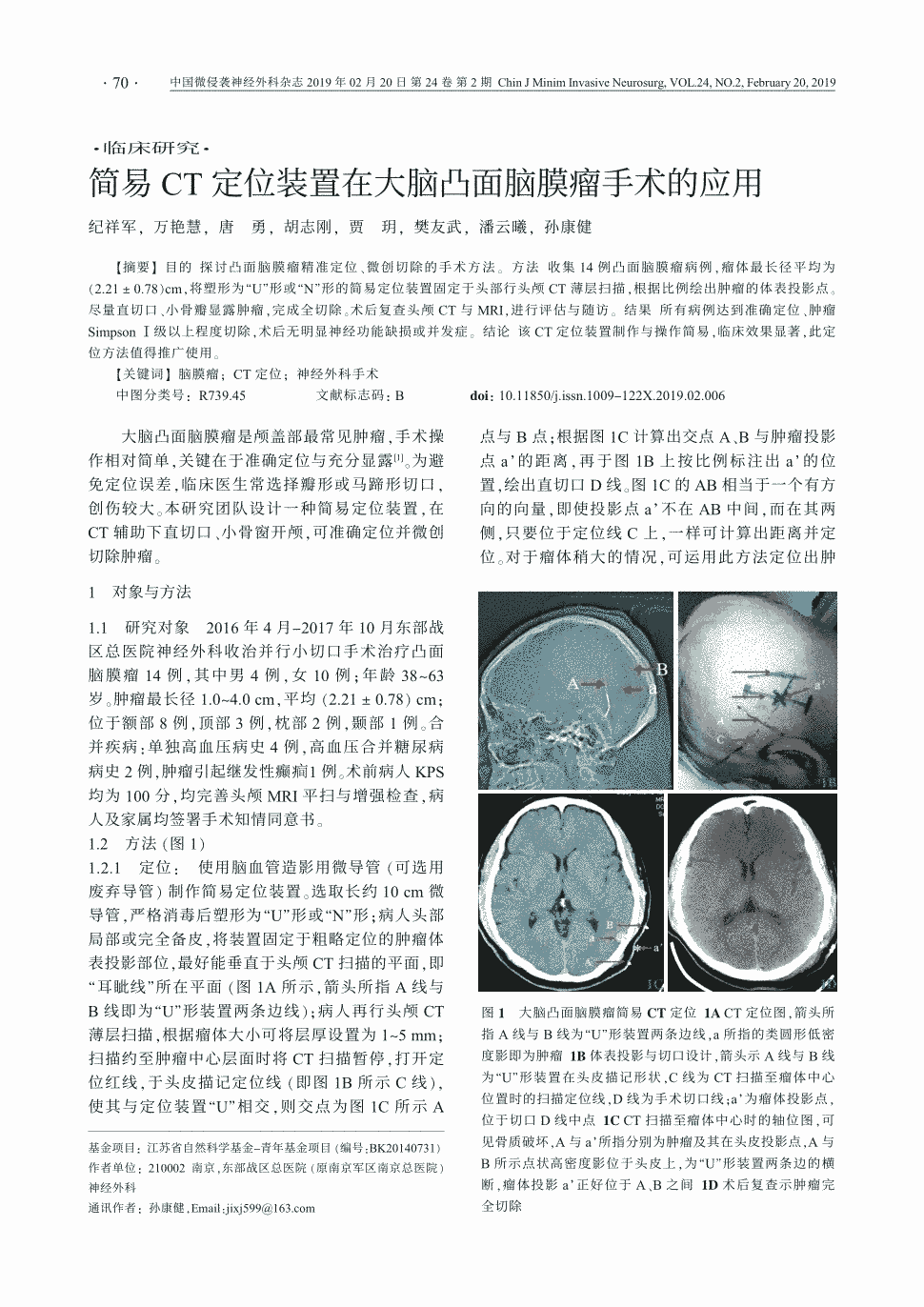 期刊简易ct定位装置在大脑凸面脑膜瘤手术的应用