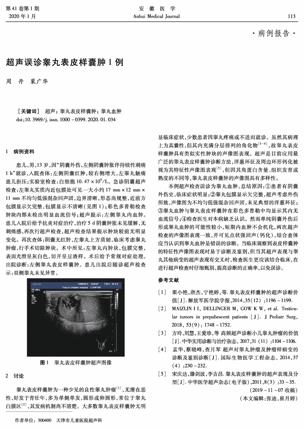 期刊超声误诊睾丸表皮样囊肿1例    1病例资料患儿,男,13岁,因"阴囊