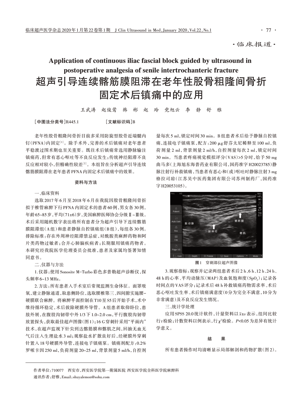 期刊超声引导连续髂筋膜阻滞在老年性股骨粗隆间骨折固定术后镇痛中