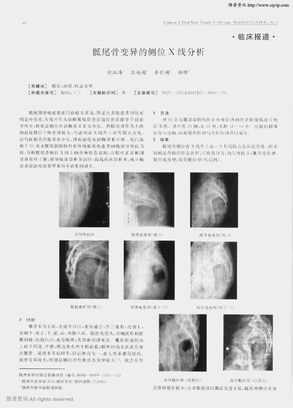 期刊骶尾骨變異的側位x線分析被引量:3